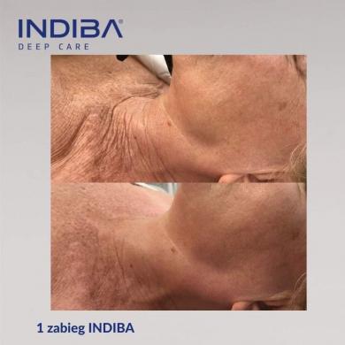 idiba-010